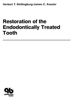 cover image of Restoration of the Endodontically Treated Tooth